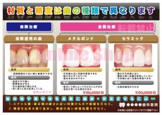 画像1: 歯科の補綴物（審美）比較ポスター (1)