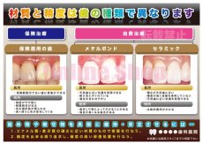 画像2: 歯科の補綴物（審美）比較ポスター (2)